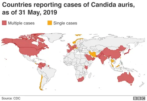 Map of Candida auris cases