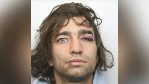 GMP Jay Conway has long brown hair, stubble and a swollen left eye with a cut over it.