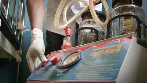 Horaci Garcia/BBC A broken breathing machine
