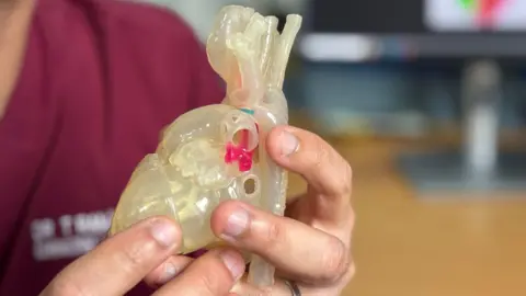 A close up of a 3D printed heart replica, similar to the one which will be made of Penny's heart. Picture is a close up of the model in the surgeon's hands.