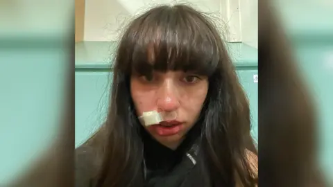 Daisy Foster Daisy looks at the camera and has a white bandage stuck to her face above her upper lip. The background is a pale green and cream wall.