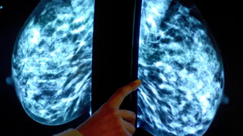 A doctor looks at a breast cancer scan