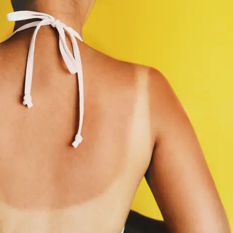 Un chemin brûlé par le soleil sur le dos d'une femme. Elle tient une sangle blanche autour de son cou et se tient devant un fond jaune.