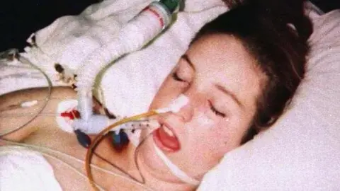 Leah Betts in a coma in a hospital bed. She has various wires and tubes attached to her. She has her eyes closed, mouth open and dark hair.