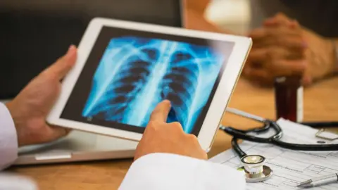 A digital tablet screen with the X-ray scan of a chest is held at a table next to a medical device and paperwork.