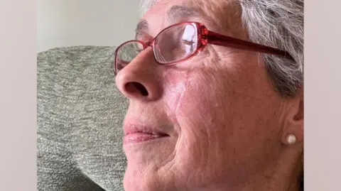 A close up picture of Miss Dales she is looking side ways and has red-rimmed glasses and a pearl earring is visible. There is a scar below her eye running down beside her nose. 