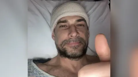 A selfie picture of Craig with a beard and moustache, lying in a hospital bed wearing a hospital gown. His head is bandaged up and he is doing a thumbs up and smiling at the camera.
