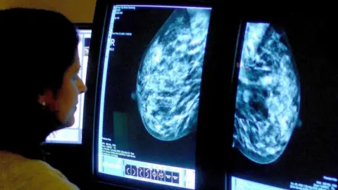 PA Media File photo of a consultant analysing a mammogram