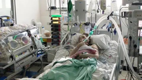 Helen holding baby Maeve. She has a large tube in her mouth and wires attached all over her body. There is a baby incubator to the left hand side  