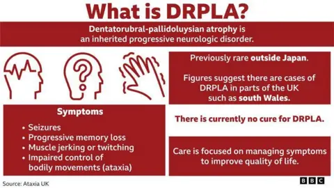 Un DRPLA gráfico que resalta y los síntomas asociados con la afección. El titular dice ¿Qué es Drpla? Debajo de la atrofia de Syas Dentatorubral-Pallidoluysian es un trastorno neurológico progresivo heredado. Debajo de eso, el subtítulo lee los síntomas y la bala puntiagudas hay cuatro síntomas que se leen: convulsiones, pérdida de memoria progresiva, sacudidas musculares o contracciones y control deteriorado de los movimientos corporales (ataxia). A la derecha de esto, dice que anteriormente fuera de Japón, y según estas lecturas, las cifras sugieren que hay casos de DRPLA en partes del Reino Unido, como Gales del Sur. Bajo esto, dice que actualmente no hay cura para DRPLA. Y la línea final en el gráfico lee la atención se centra en manejar los síntomas para mejorar la calidad de vida.