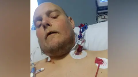 A bearded bald man lies in a hospital bed with his eyes closed. Several probes are attached to his chest and a monitor screen can be seen in the background. 