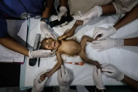 Alain Schroeder A young orangutan is sedated and prepared for surgery by a team of specialists