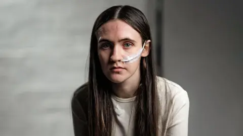 Kara sees the camera against a dark, neutral background. A nose blooming tube is running in his nose from behind his ear. He has a middle farewell and long black hair in blue eyes. She wears a plain off-white jumper.