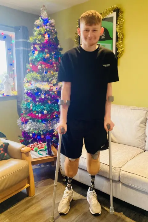 Teenage boy smiling at camera, standing using crutches, with two prosthetic legs below his knee, decorated Christmas tree in the corner.