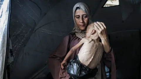 A Gazan mother holds her severely emaciated baby son