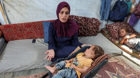 Reuters The mother of Palestinian boy Abdul Rahman Abu Al-Jidyan, the first person to be diagnosed with polio in Gaza in 25 years, speaks with her hands as she cares for him in their tent, in Deir Al-Balah, in the middle of the Gaza Strip August 28. , 2024.