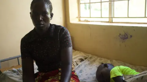 Achan Nighty, 40, sits next to her sleeping son Opio Innocent at hospital