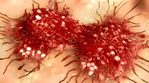 selvanegra/Getty Images Cancer cell dividing