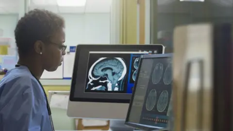 Getty Images Doctor looking at brain scans