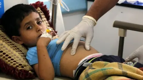 EPA A Yemeni child suspected of being infected with cholera receives treatment at a hospital in Sanaa (15 June 2017)