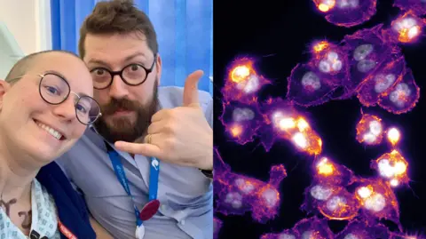 There are two images side by side. In the left image is a close-up shot of a man and a woman smiling at the camera. On the right is a scan showing purple shapes with yellow and white spots on a black background.