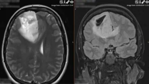 Family photograph Scan image showing brain tumour