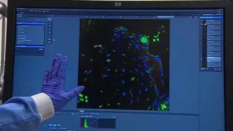 An image of a computer screen showing what different cells display. The tissue has been stained and blue, green and red colours could be seen. A researcher's hand in a blue latex glove is seen pointing at the image.