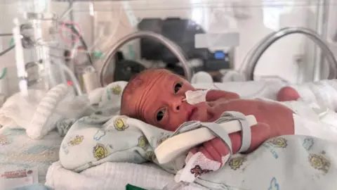 Supplied Baby Jude in the neonatal unit. He is inside an incubator and has a tube coming out of his nose and one on his hand. He is naked, except for a nappy. He is looking up to the camera with big wide eyes.