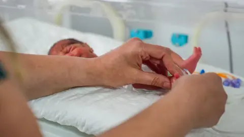 Getty Images A tiny baby is seen laying in a neonatal intensive care bed. A pair of hands tends to the baby's foot. The infant lies on a white pad mattress.