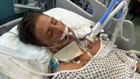 Doina Prisacaru A man who appears asleep lying on a hospital bed wearing a white hospital gown. Various medical tubes and wires are attached to his chest and face.