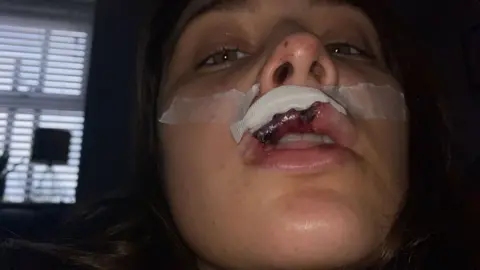 Erin Evans Erin Evans has a plaster over her top lip where there are visible extensive injuries and bruising. She has long dark hair and is sat in a dark room with a window behind her. 