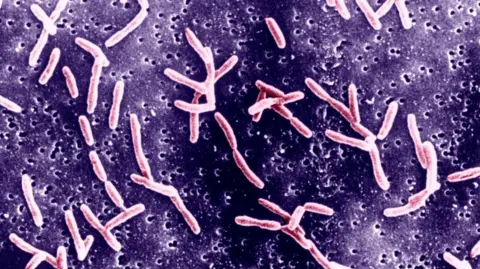 Getty Images Campylobacter adalah keluarga bakteri negatif gram melengkung.