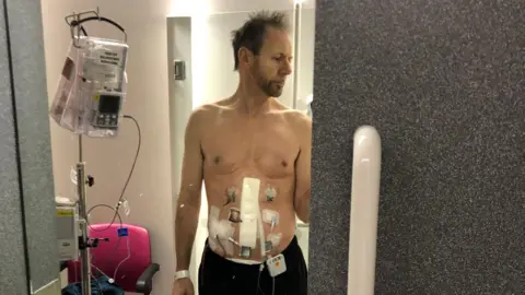 Billy Murray during treatment