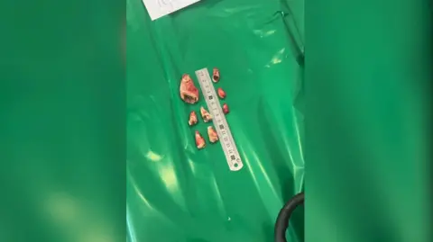 IAR Misha's removed teeth