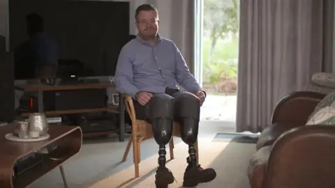 BBC Neil Hopper is sitting in his lounge. He has prosthetic legs and is wearing a blue shirt and a pair of glasses.