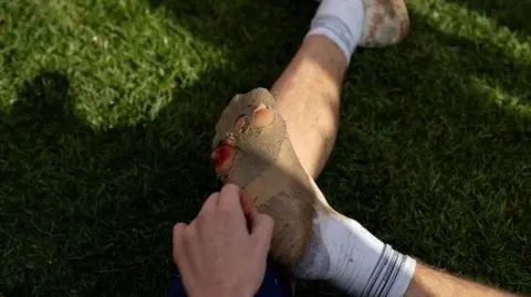 sammellishphoto Michael Clark's right foot, which is covered in sand and blood. There are holes in his white sock which he is peeling back with his hand. His foot is resting on one of his legs.