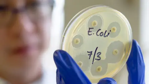 GETTY Scientist holding up sample of E. coli growing in a lab