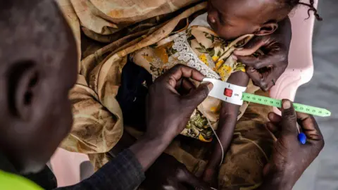 AFP A health worker measures the arm circumference of a Sudanese child at the Refugee Transit Center clinic in Renk, South Sudan, in February.