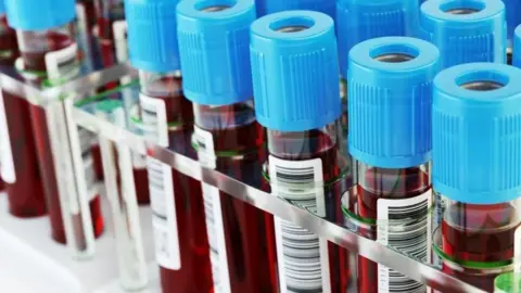 Getty Images Blood test tubes