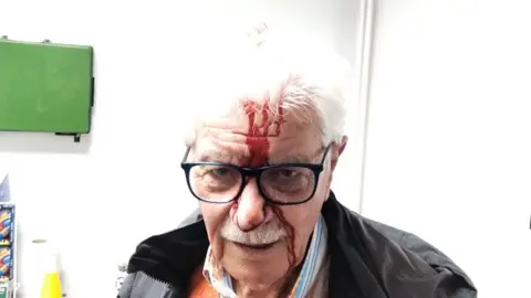 Daniel Bennett Trevor Emery with an injured head