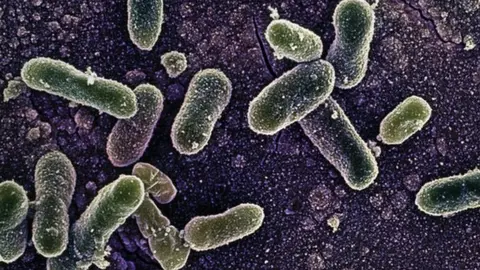 Science Photo Library Salmonella Enteritidis bacterium