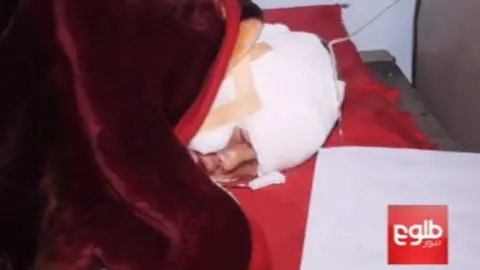 Reuters person with bandaged head