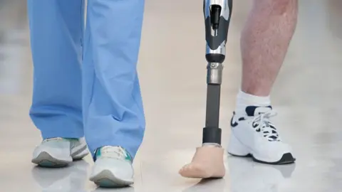 A stock image of two pairs of legs walking down a hallway. One person is wearing light blue medical scrubs and trainers, while the other has one prosthetic foot and a trainer on the other leg.