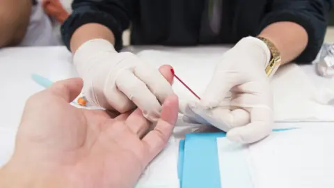 Getty Images Blood test for HIV