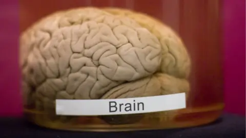 Getty Images A brain