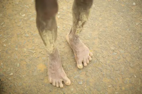 BBC The tired, mud-coated legs of a fleeing Rohingya person