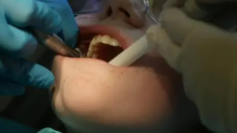 Jenna having dental work