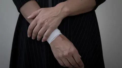 Getty Images Woman with bandage on her arm