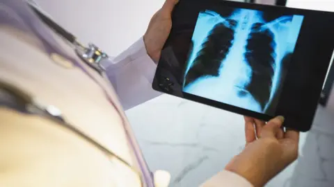 Getty Images A stock image of a doctor holding an X-ray