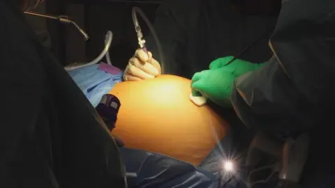 Cosmedacare surgery pic